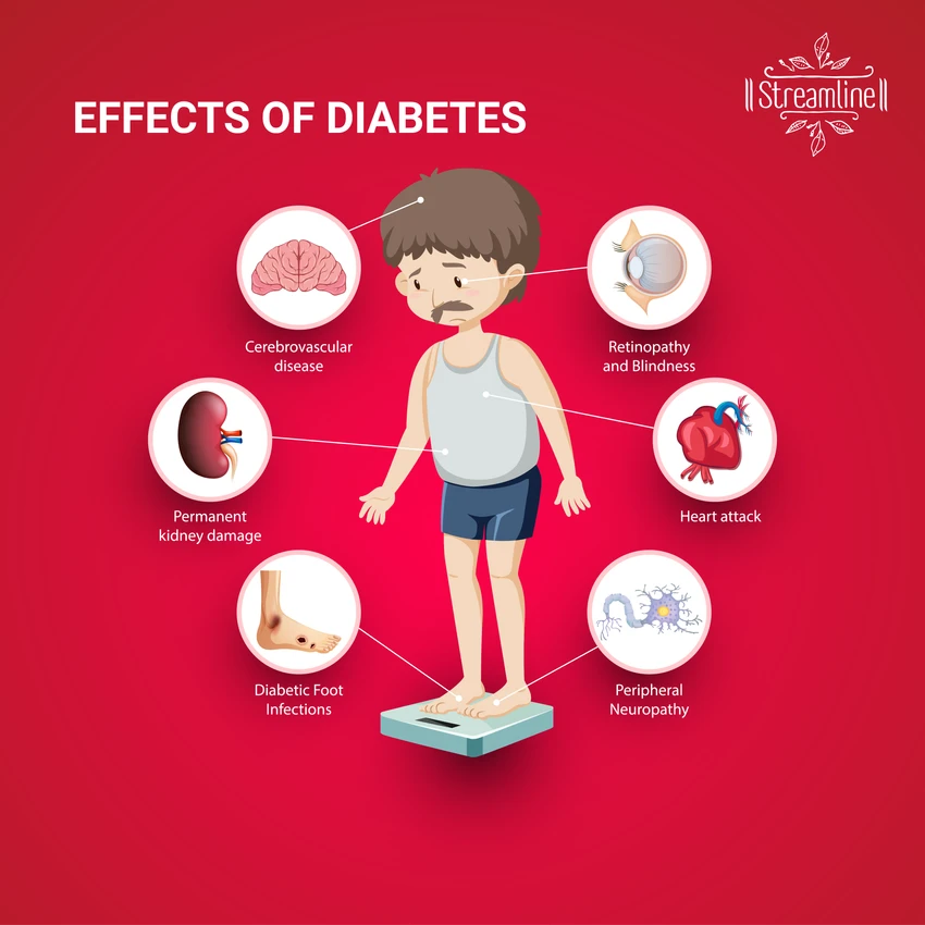 STREAMLINE DABICUT CAPSULES | Herbal Medicine for Diabetes Control